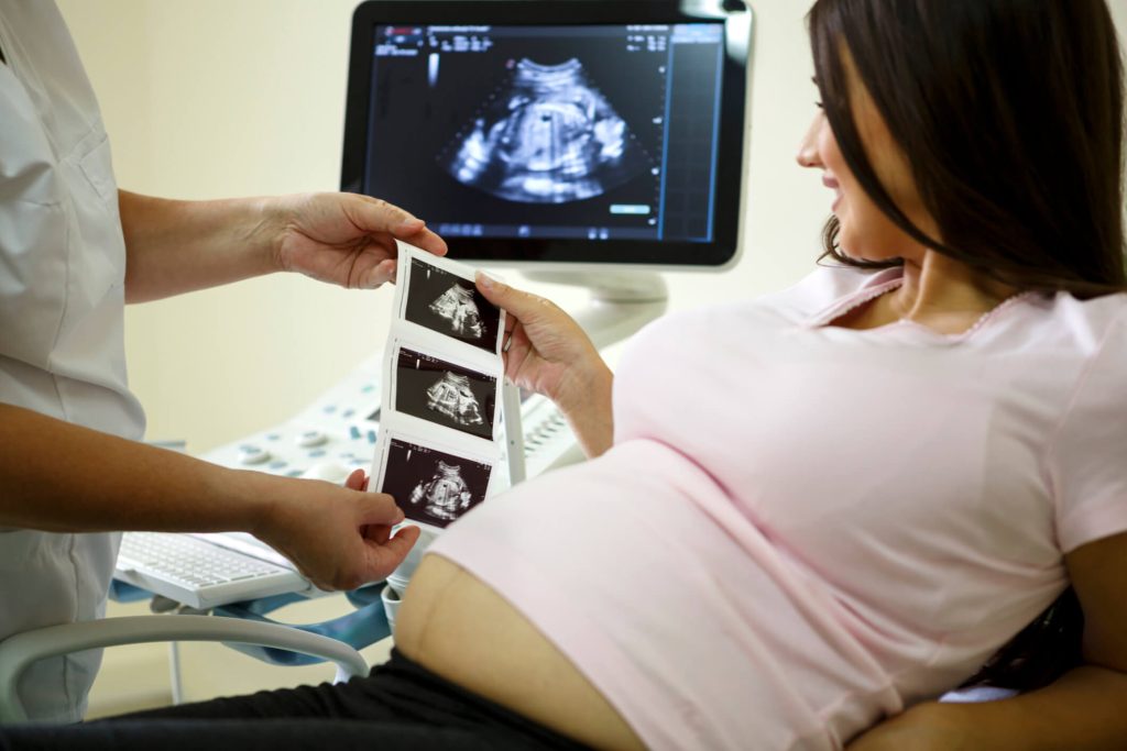 woman with ultrasound and clinic worker receiving ultrasound pictures (1)